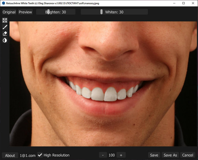 Retouch4me White Teeth